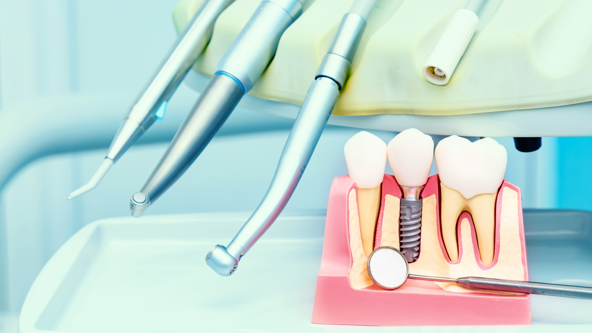 Implantologia - rewolucja w przywracaniu utraconych zębów 
