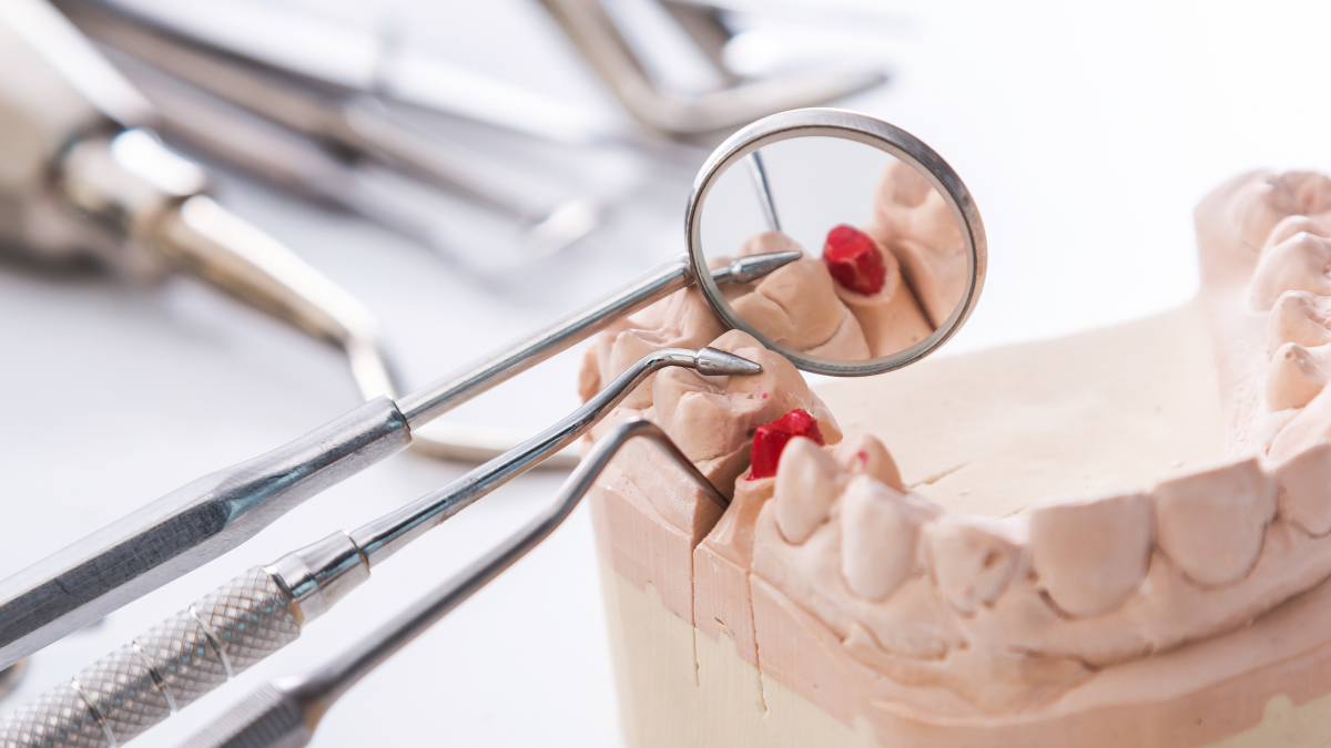 Periodontologia - czyli choroby przyzębia. Jakie są objawy i jak zapobiegać ich występowaniu? 