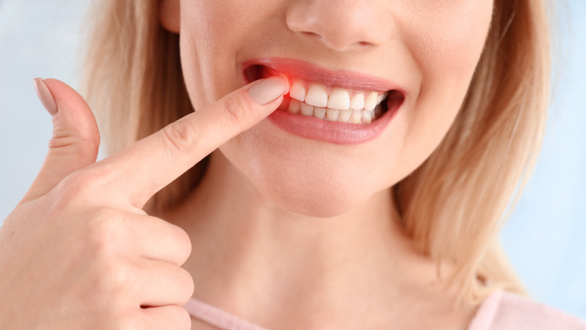  Czy higiena jamy ustnej wpływa na stan dziąseł? 